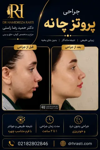 Before and after chin implant surgery
