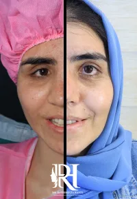 شکستگی صورت شکستگی صورت