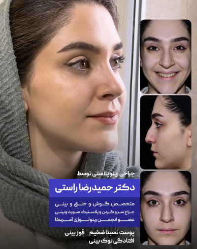 hanie hoseini-Recovered hanie hoseini-Recovered