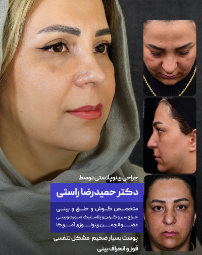 nesa hoseini 1 nesa hoseini 1