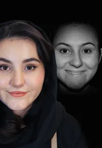 جراحی بینی کج